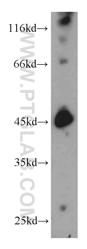 WB analysis of mouse brain using 12011-1-AP