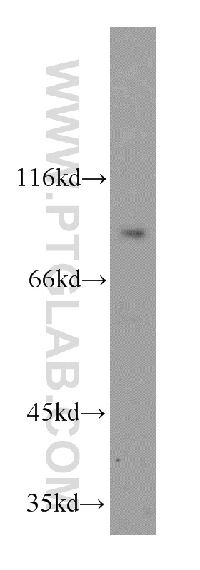 WB analysis of HepG2 using 17594-1-AP