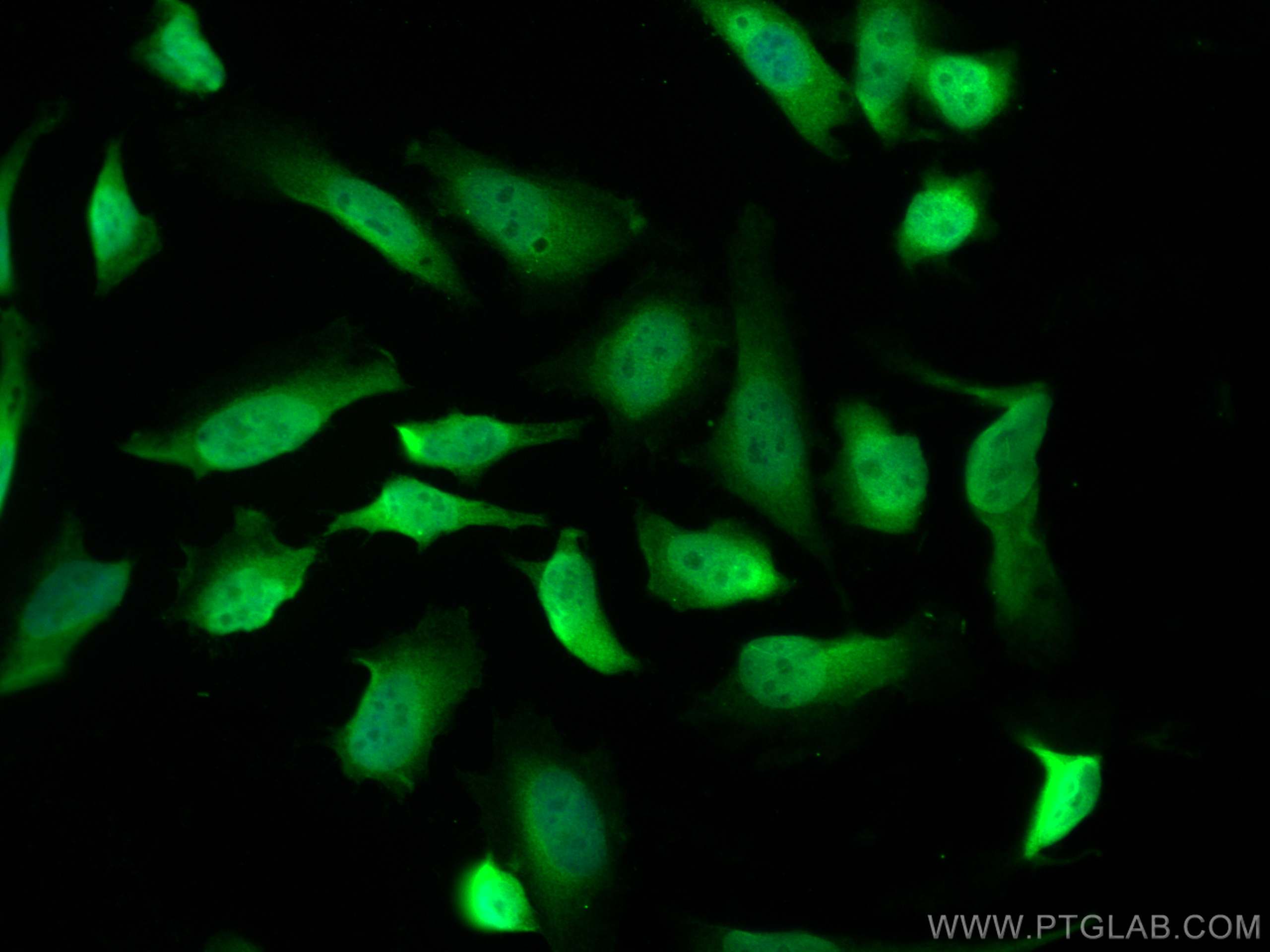 IF Staining of HeLa using 26183-1-AP