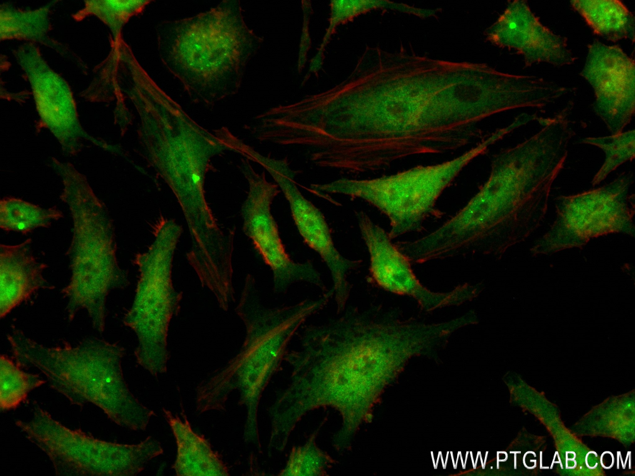 IF Staining of HeLa using 81584-4-RR