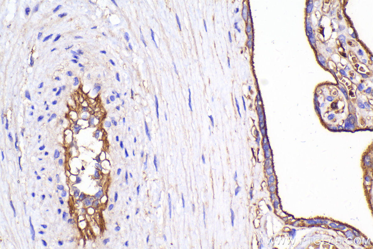 IHC staining of human placenta using 10825-1-AP