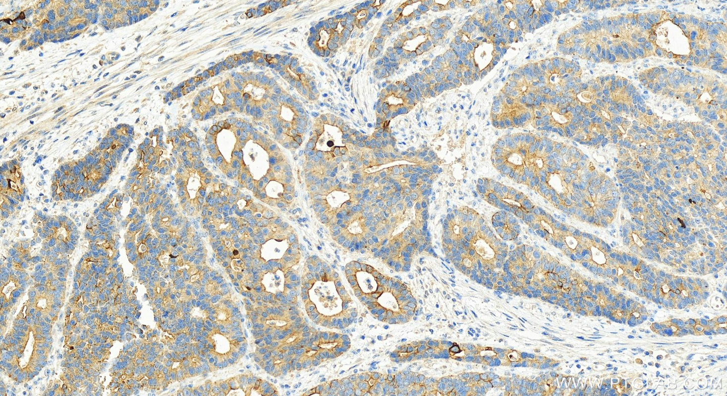 IHC staining of human stomach using 12704-1-AP