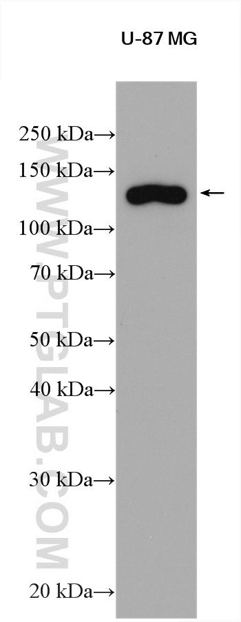 WB analysis using 29461-1-AP