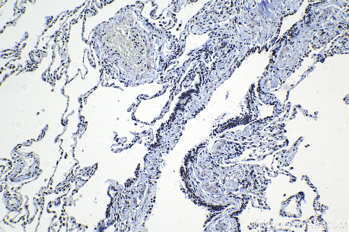 IHC staining of human lung using 17368-1-AP