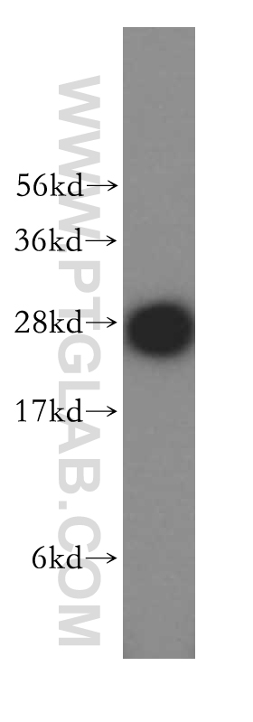 WB analysis of HeLa using 17368-1-AP