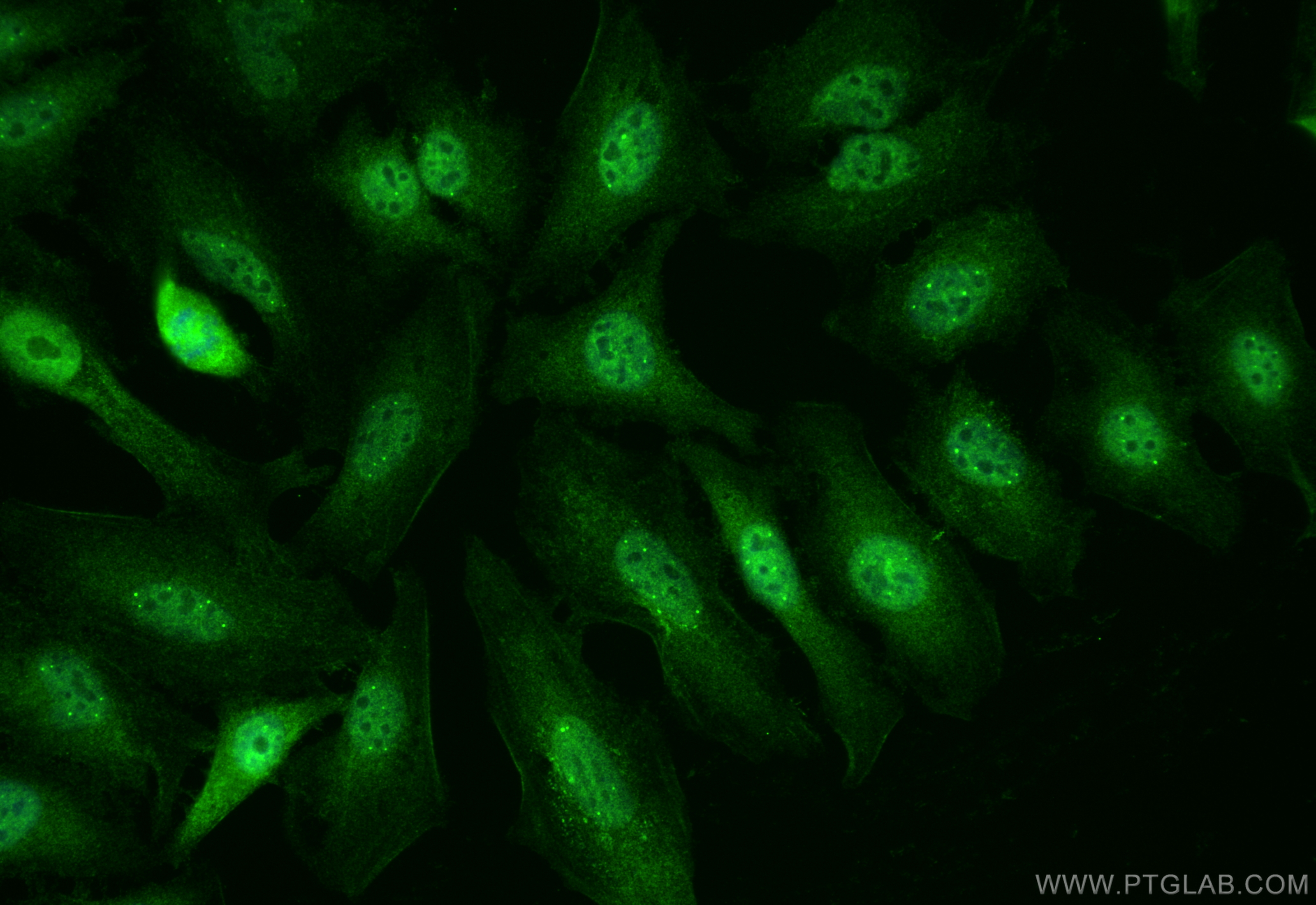 IF Staining of HeLa using 11070-1-AP