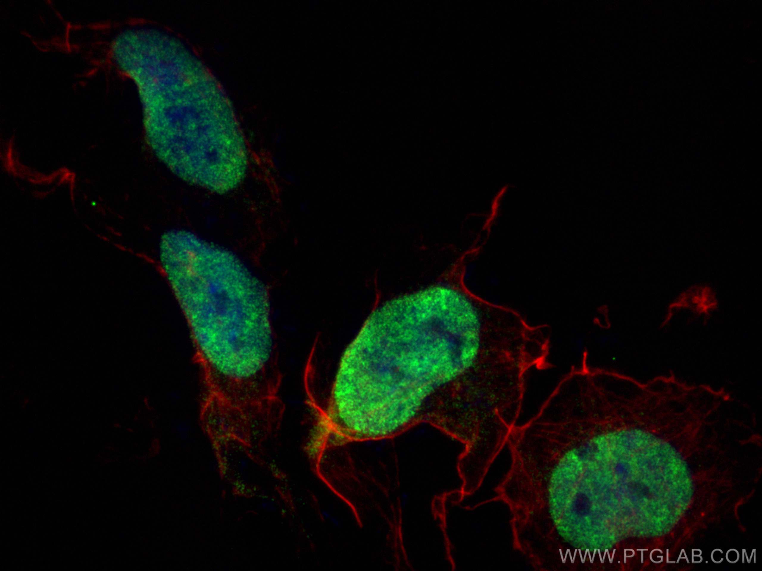 IF Staining of SH-SY5Y using 67280-1-Ig