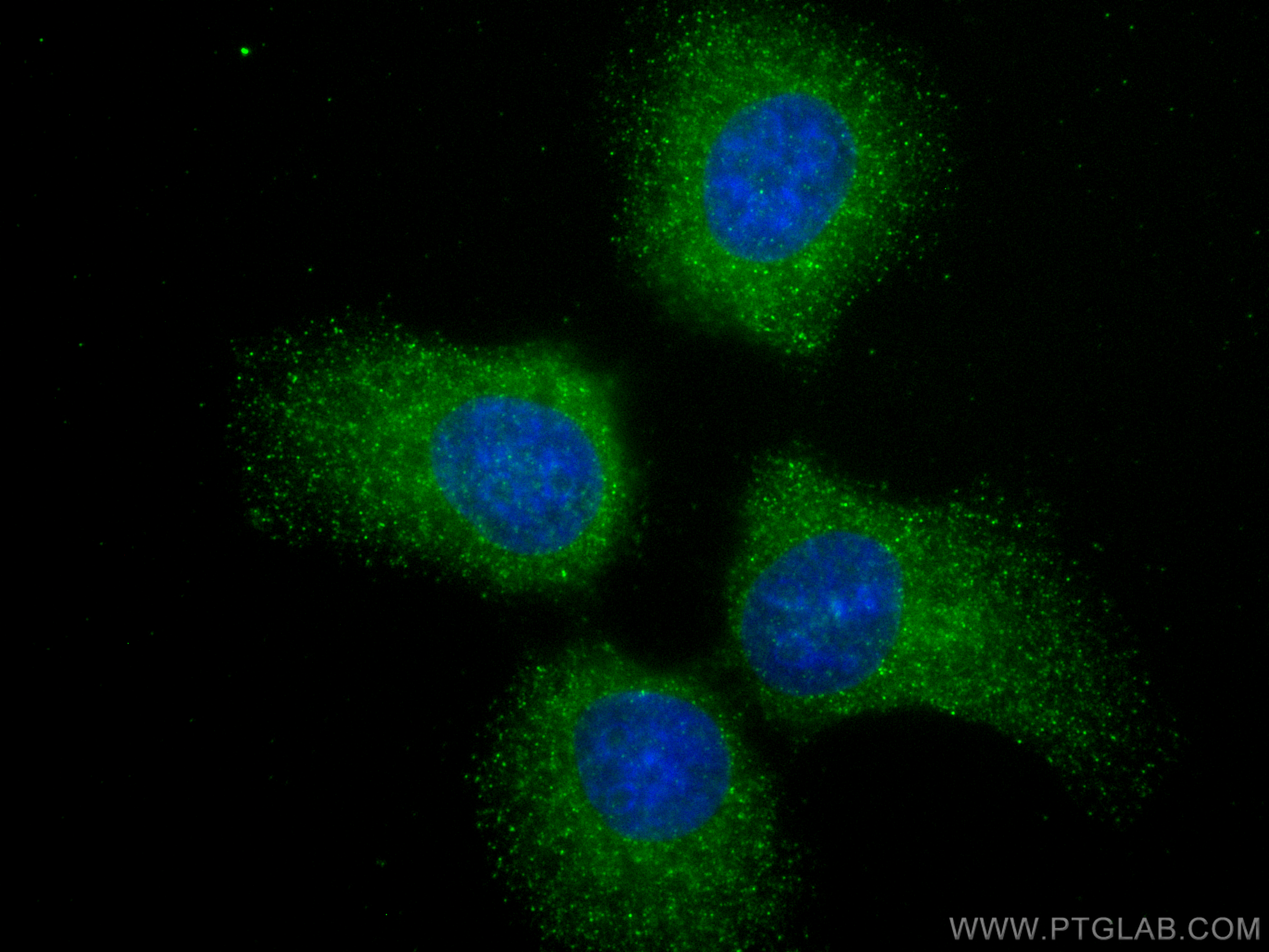 IF Staining of A431 using 68305-1-Ig