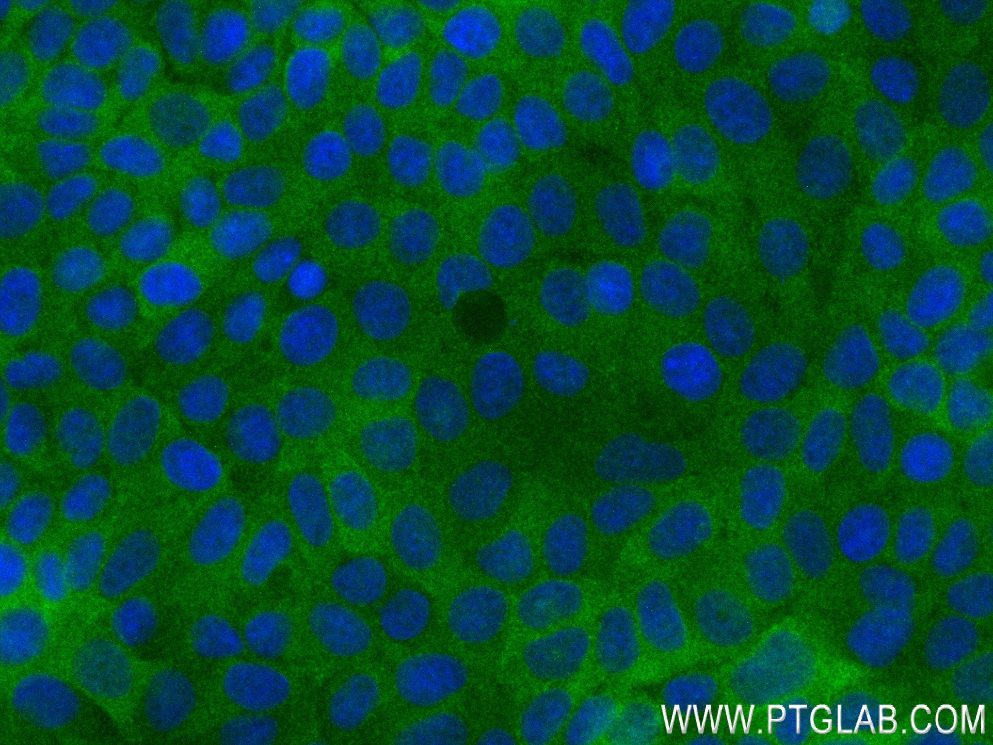 IF Staining of MCF-7 using 84215-1-RR (same clone as 84215-1-PBS)