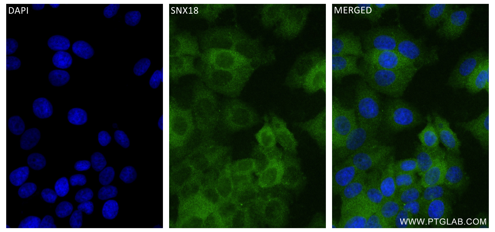 IF Staining of MCF-7 using 84215-4-RR (same clone as 84215-4-PBS)