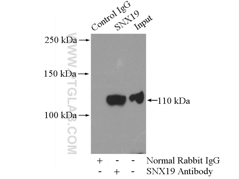 IP experiment of Raji using 13410-1-AP