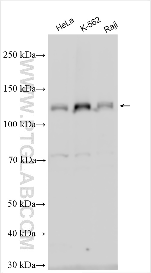 WB analysis using 13410-1-AP