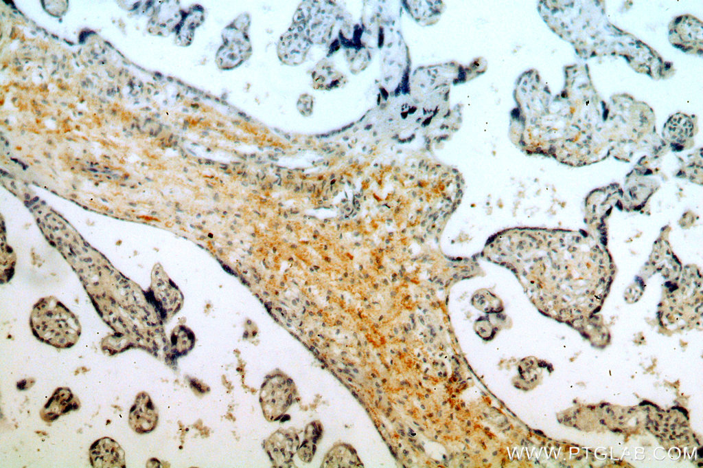 IHC staining of human placenta using 13180-1-AP