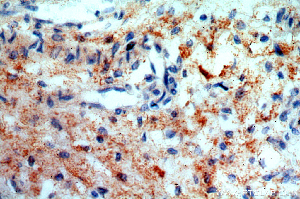 IHC staining of human placenta using 13180-1-AP