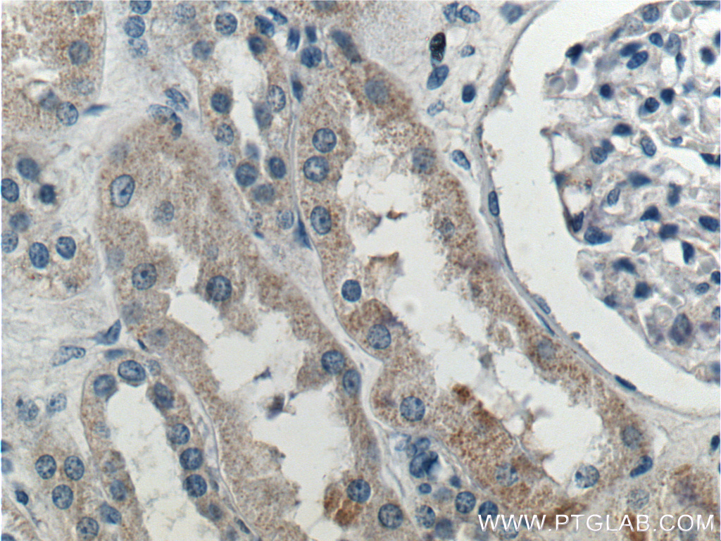 IHC staining of human kidney using 22193-1-AP