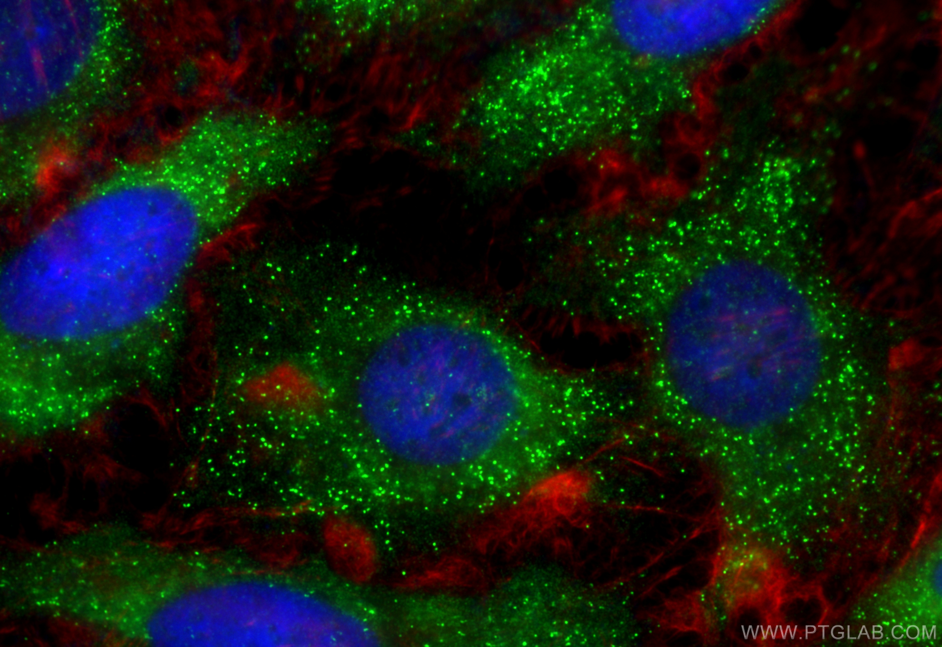 IF Staining of HeLa using 13294-1-AP