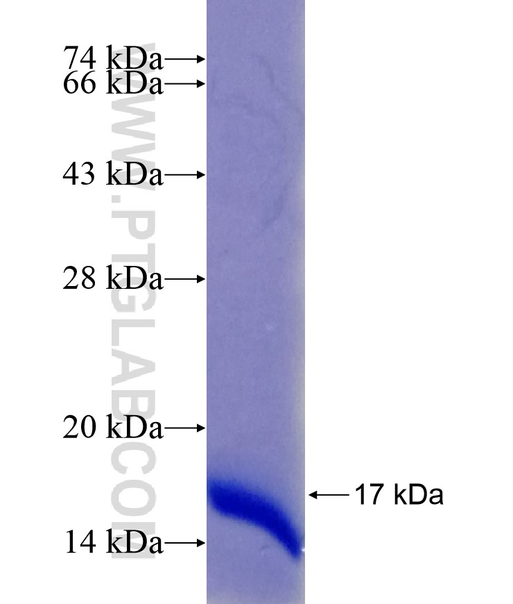 SNX27 fusion protein Ag29203 SDS-PAGE