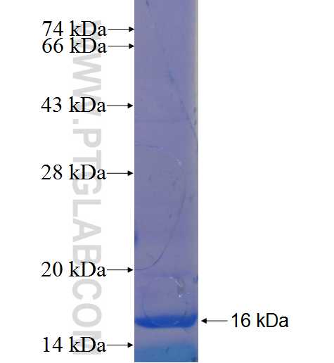 SNX32 fusion protein Ag22621 SDS-PAGE