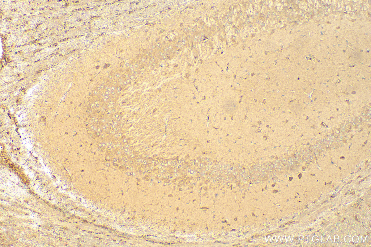 IHC staining of mouse brain using 17918-1-AP