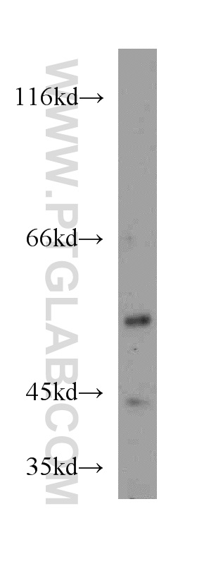 WB analysis of HeLa using 12269-1-AP