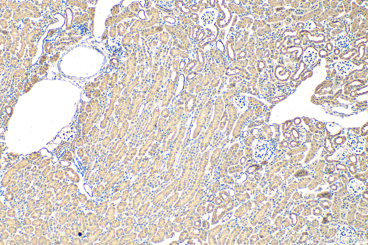 IHC staining of mouse kidney using 11494-1-AP