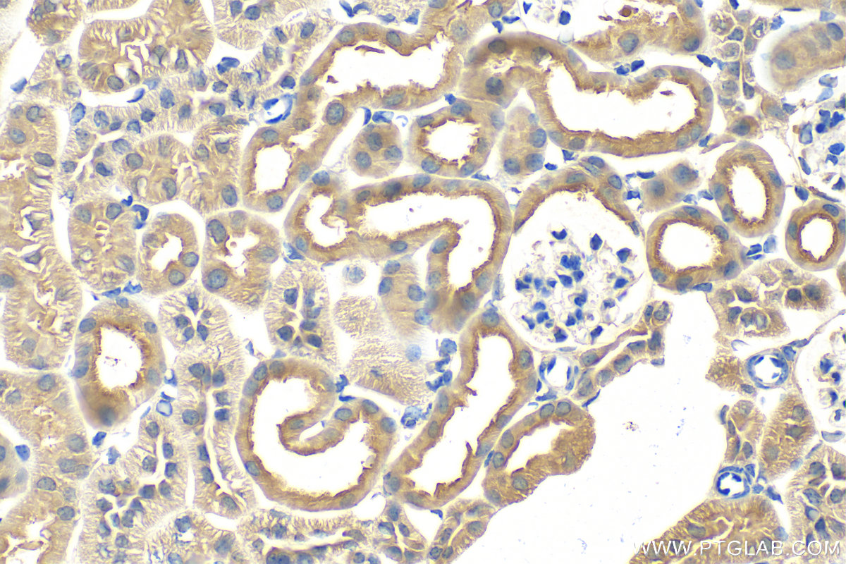 IHC staining of mouse kidney using 11494-1-AP