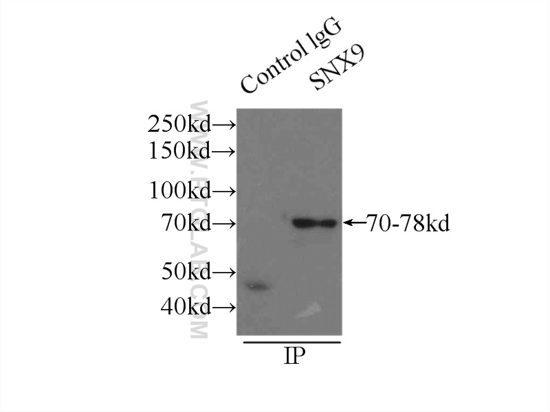 IP experiment of mouse heart using 15721-1-AP