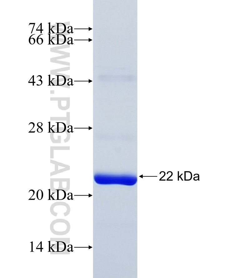 SOAT1 fusion protein Ag30956 SDS-PAGE