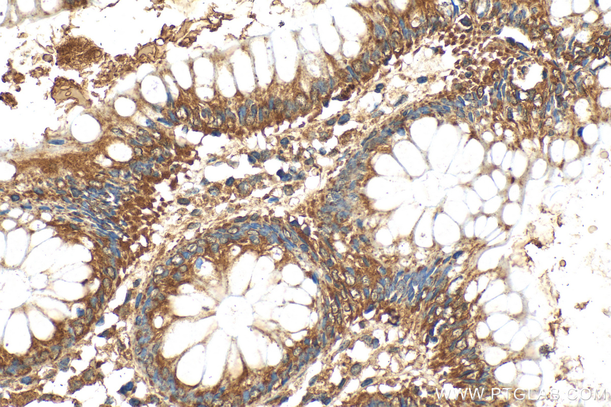 IHC staining of human colon using 27343-1-AP