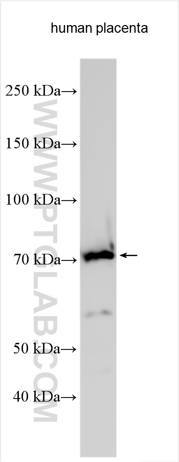 WB analysis using 27343-1-AP