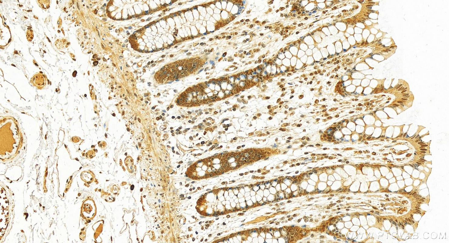 IHC staining of human colon using 10269-1-AP