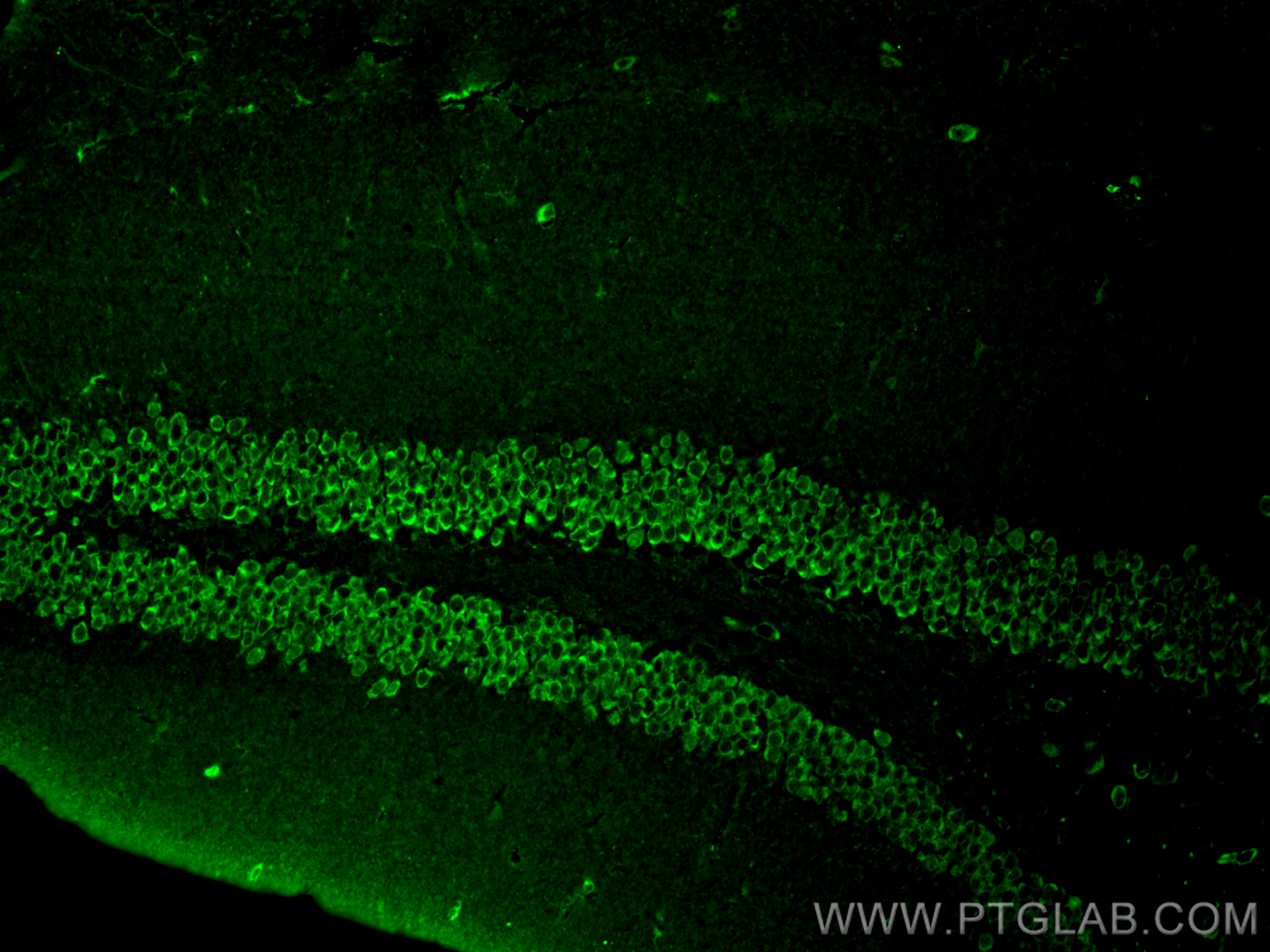 IF Staining of mouse brain using 10269-1-AP