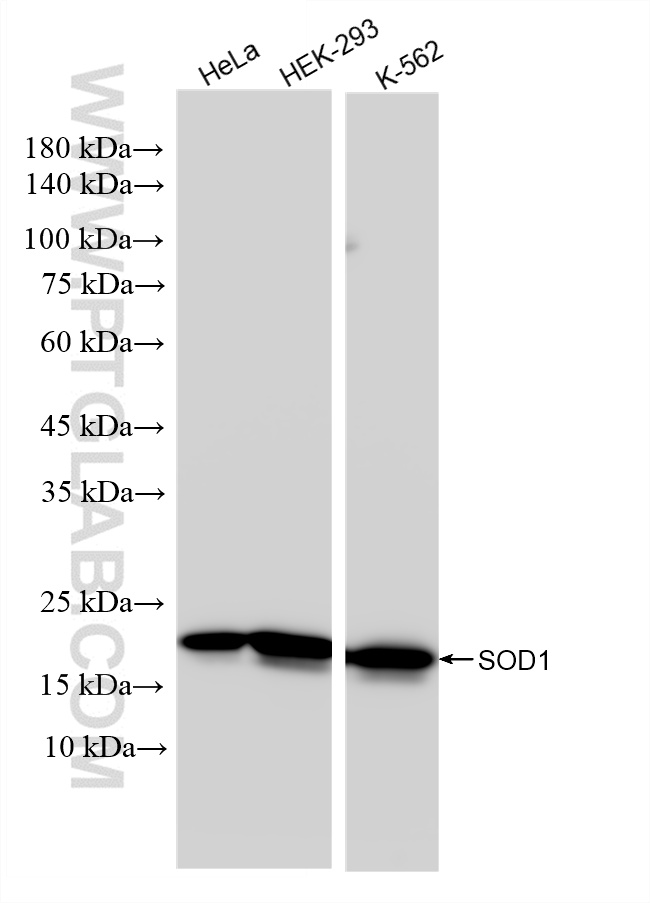 WB analysis using 83857-6-RR