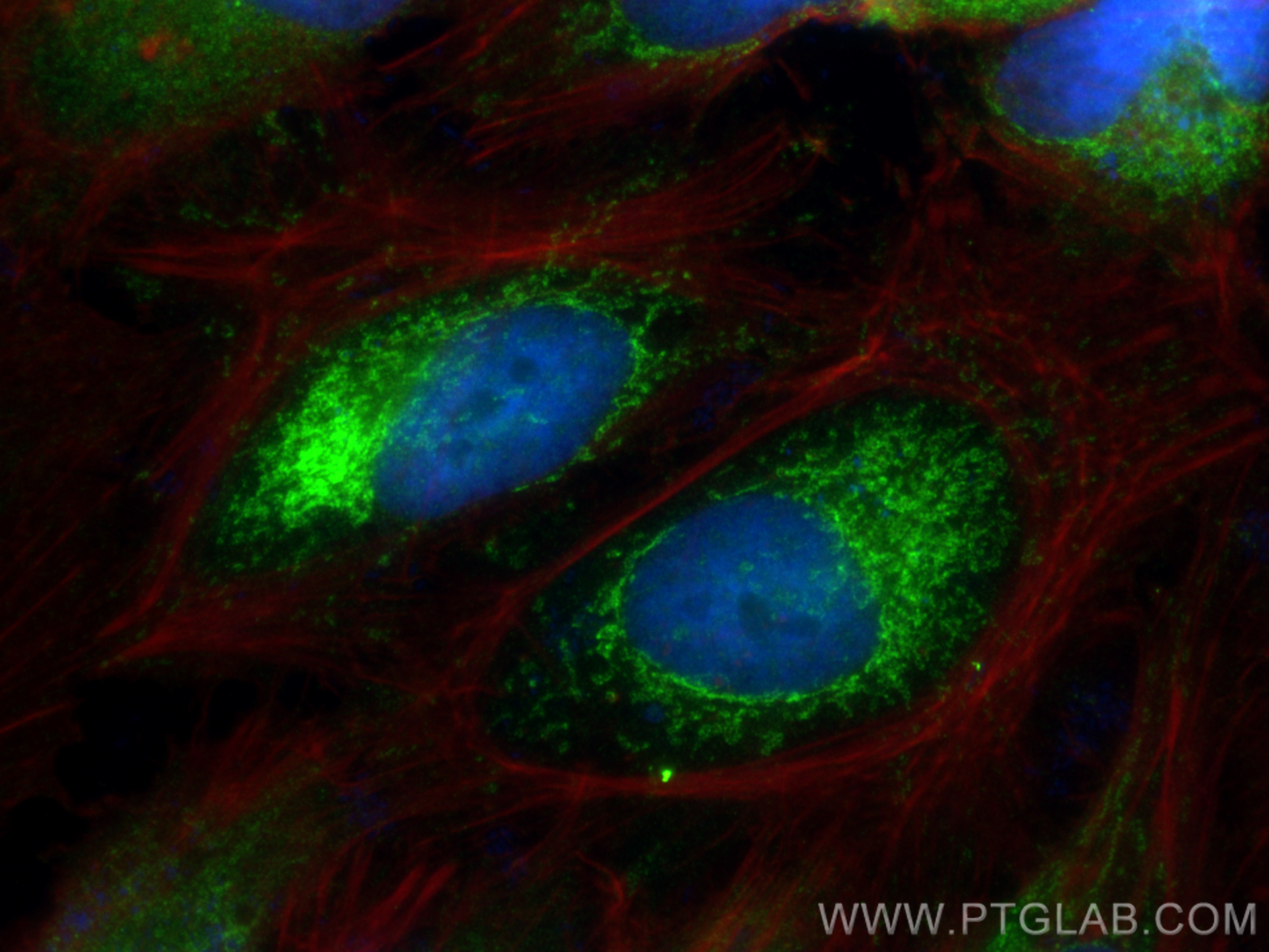 IF Staining of HeLa using 24127-1-AP