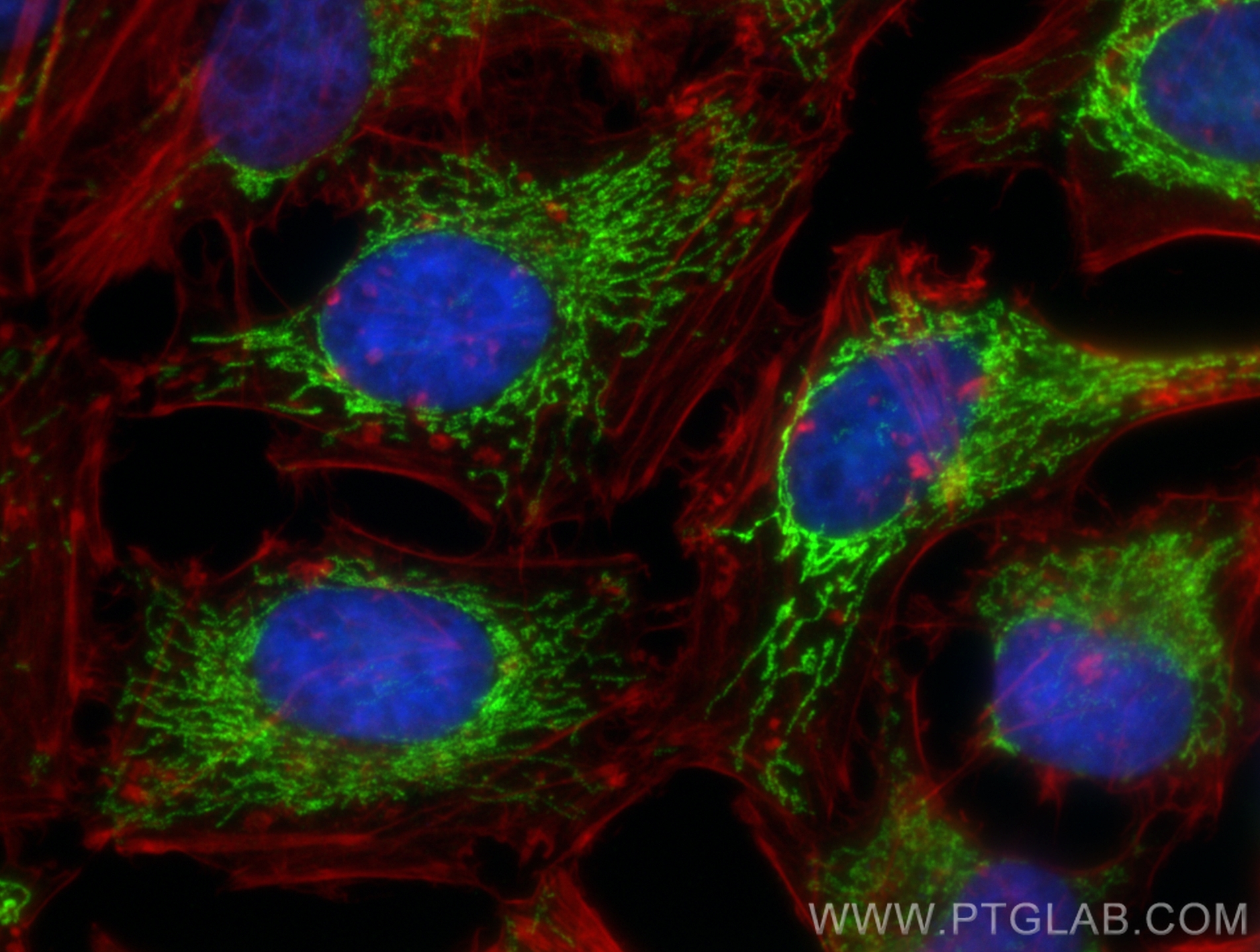 IF Staining of HeLa using 83519-2-RR