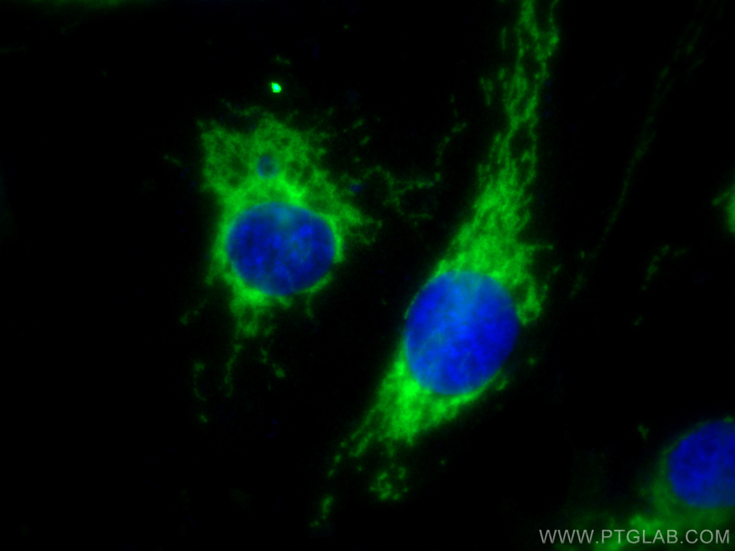 IF Staining of HUVEC using 83519-3-RR (same clone as 83519-3-PBS)