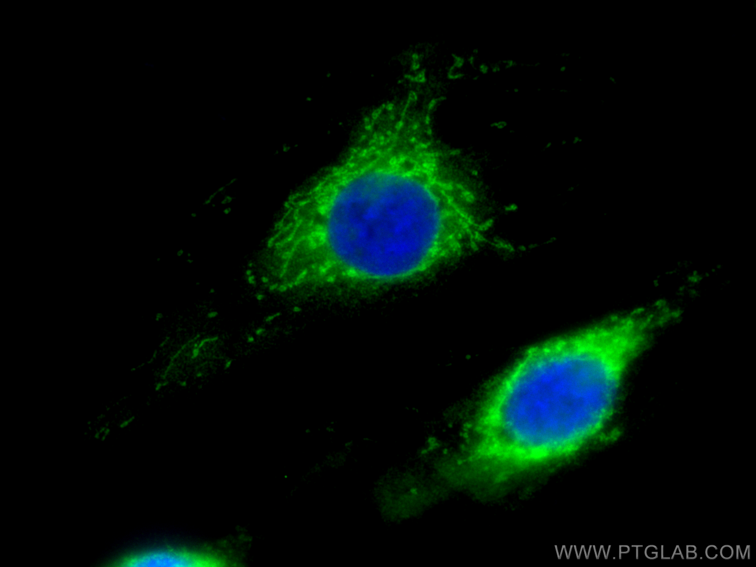 IF Staining of HUVEC using 83519-4-RR (same clone as 83519-4-PBS)