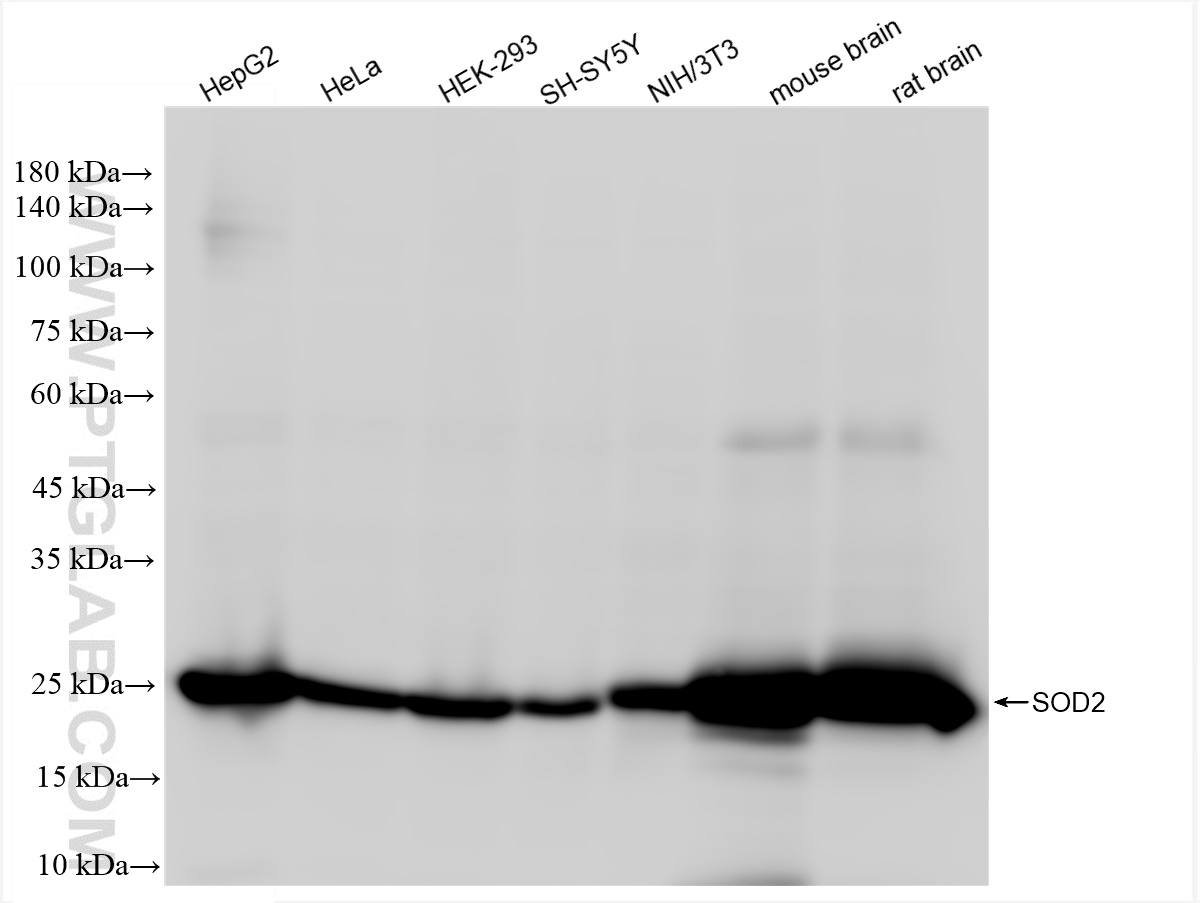 WB analysis using 83519-4-RR (same clone as 83519-4-PBS)