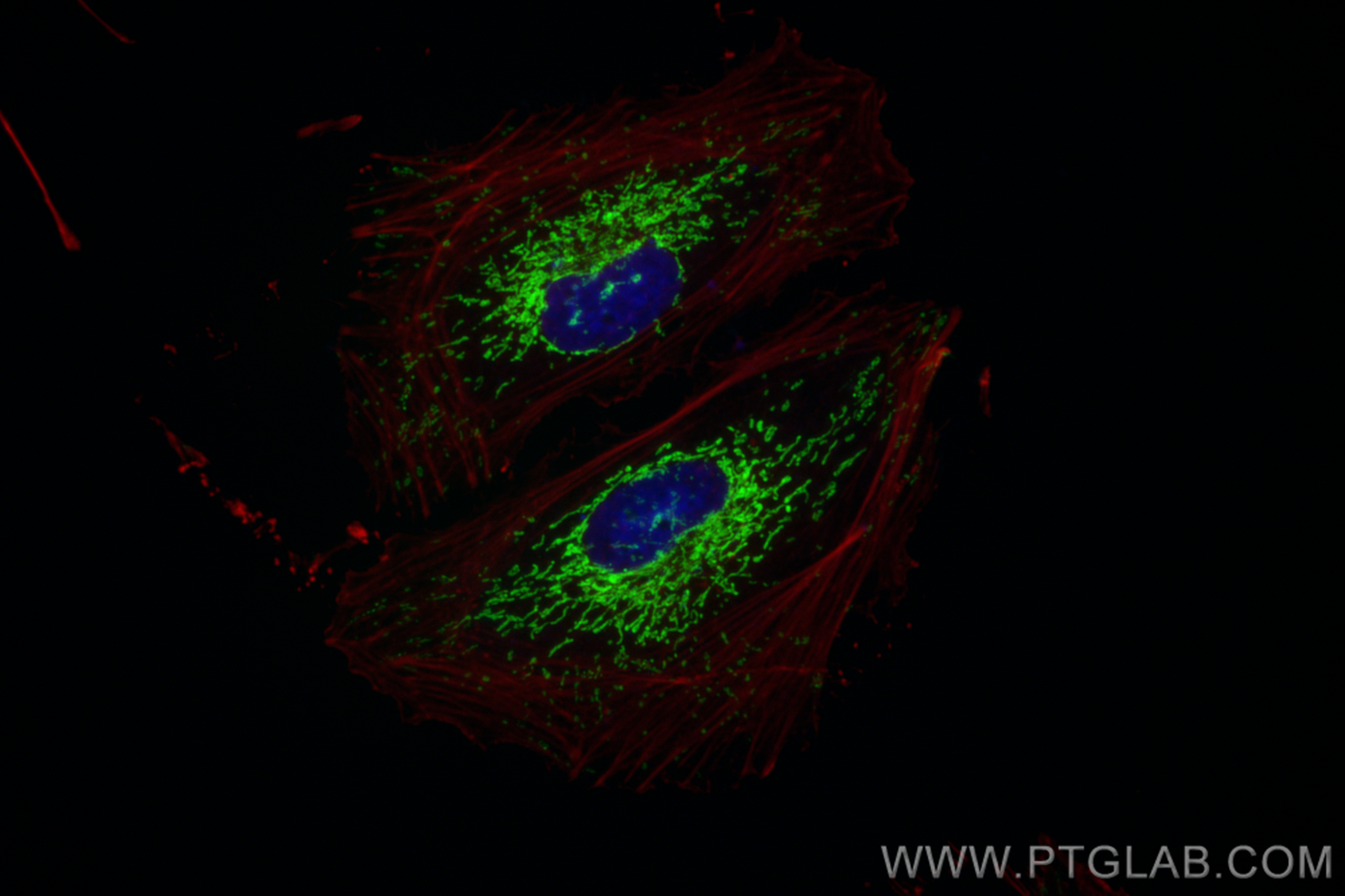 IF Staining of HeLa using CL488-83519-2