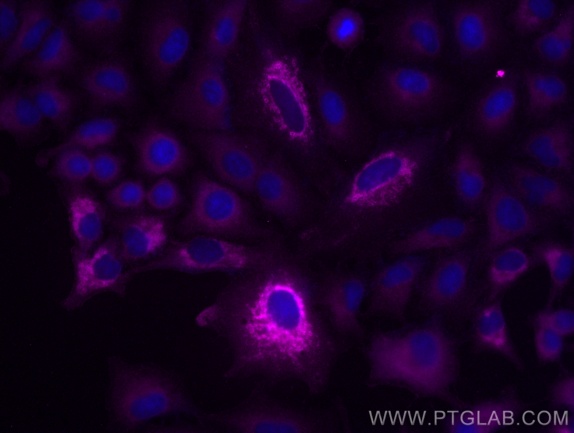 IF Staining of A549 using CL647-66474