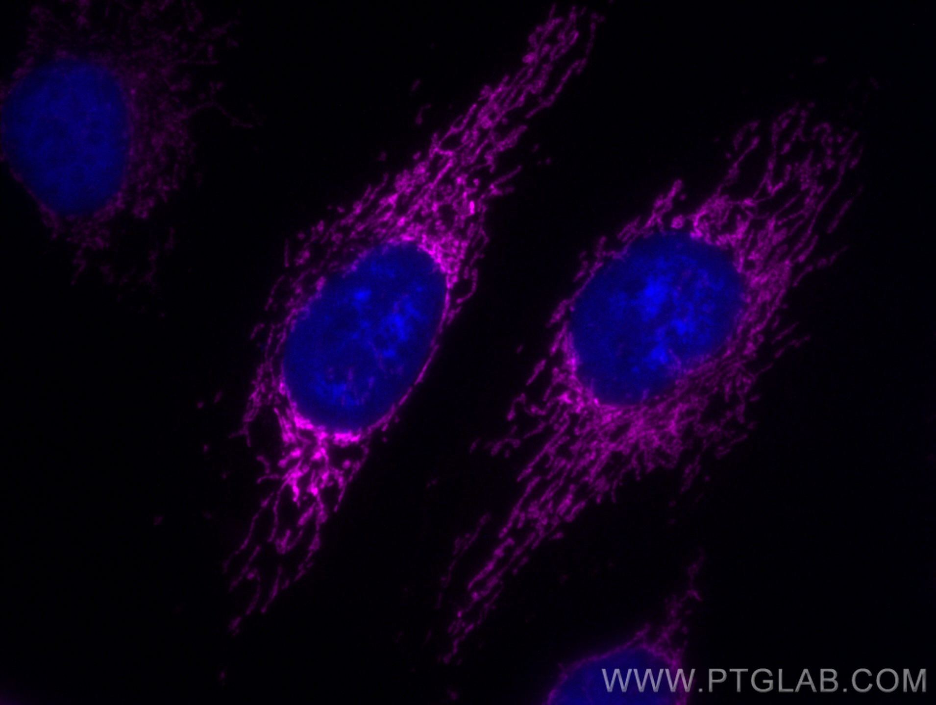 IF Staining of HeLa using CL647-83519-2