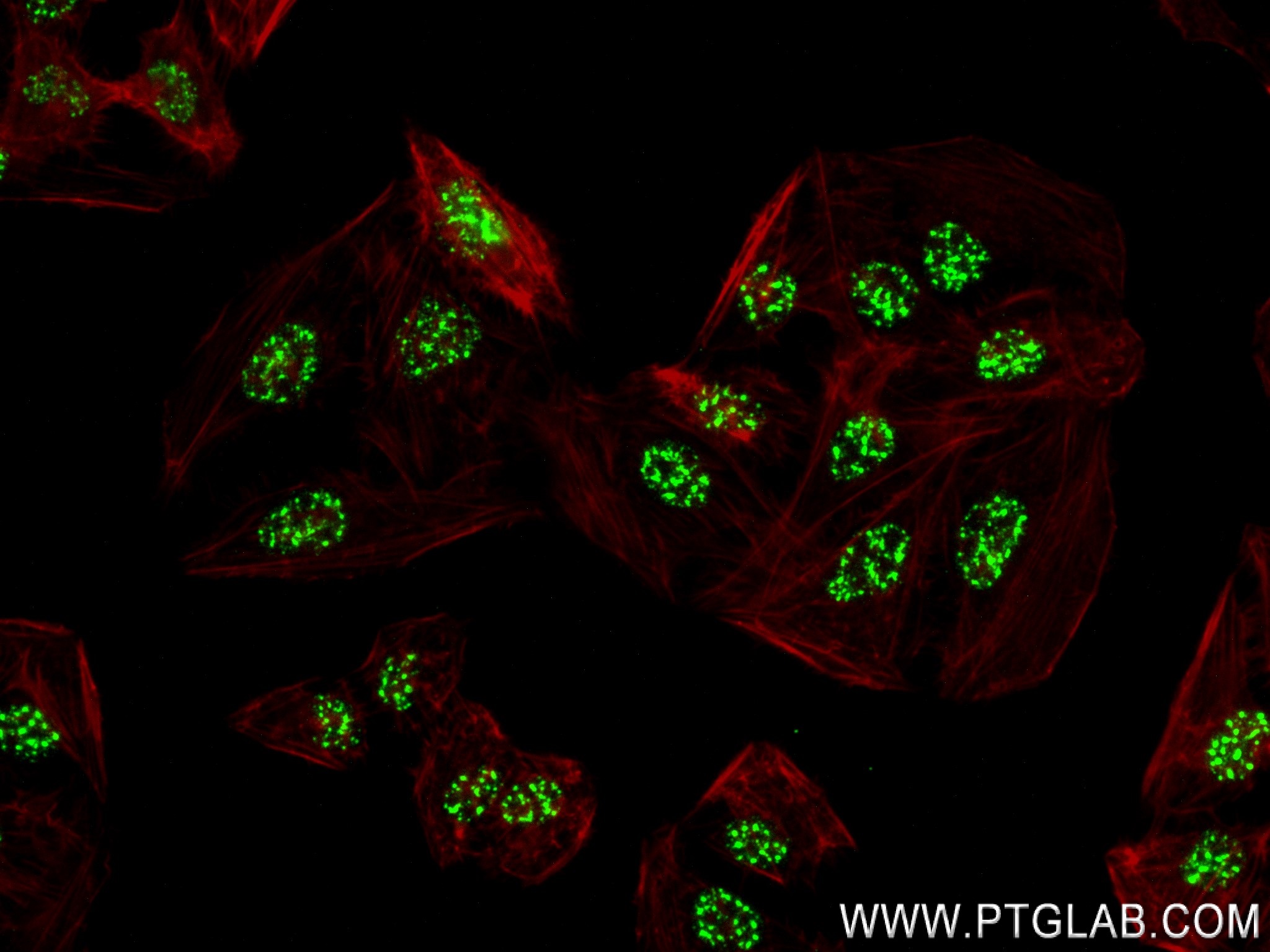 IF Staining of U2OS using 83787-5-RR (same clone as 83787-5-PBS)