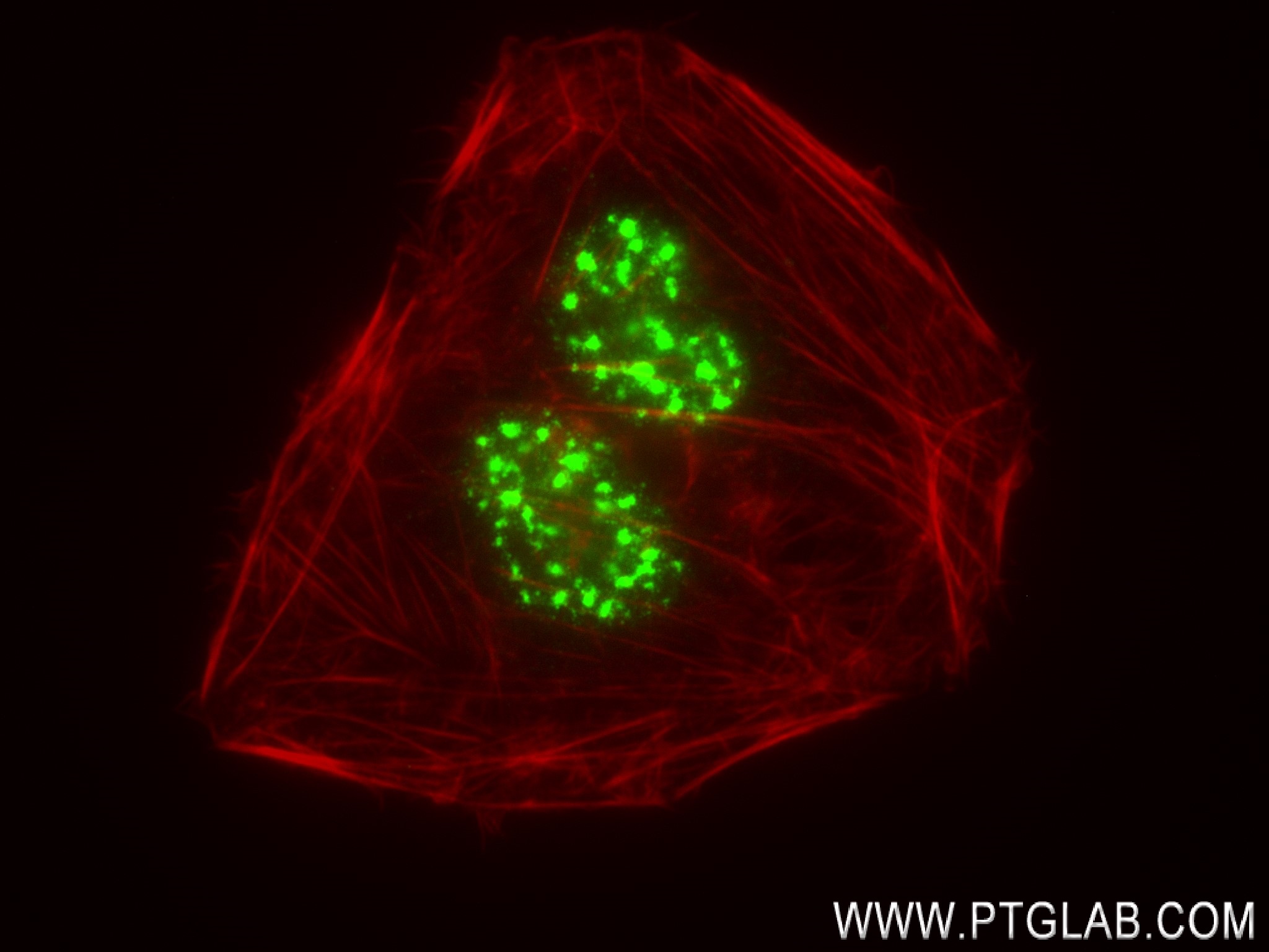 IF Staining of U2OS using 83787-5-RR (same clone as 83787-5-PBS)