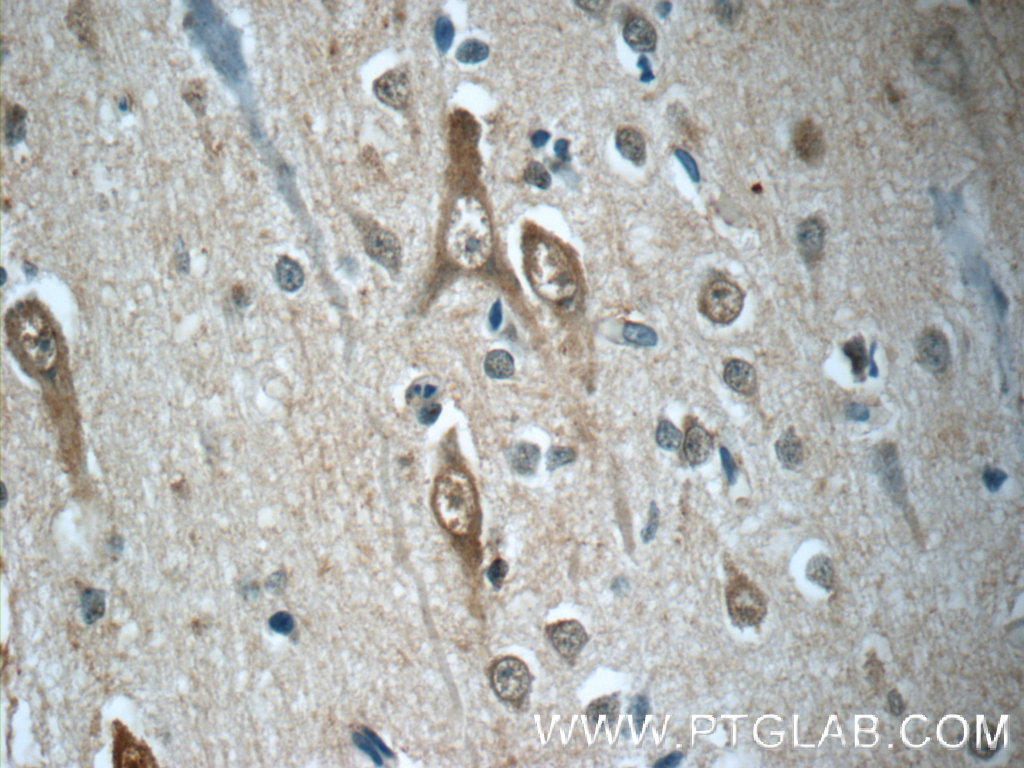 IHC staining of human brain using 23002-1-AP