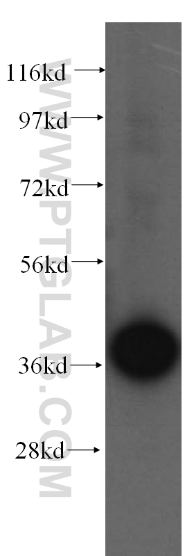 Sorbitol dehydrogenase