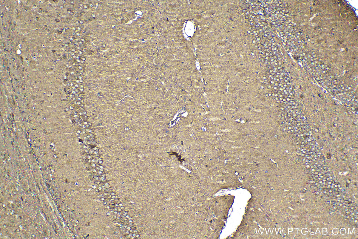 IHC staining of mouse brain using 22592-1-AP