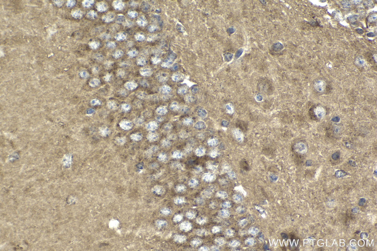 IHC staining of mouse brain using 22592-1-AP