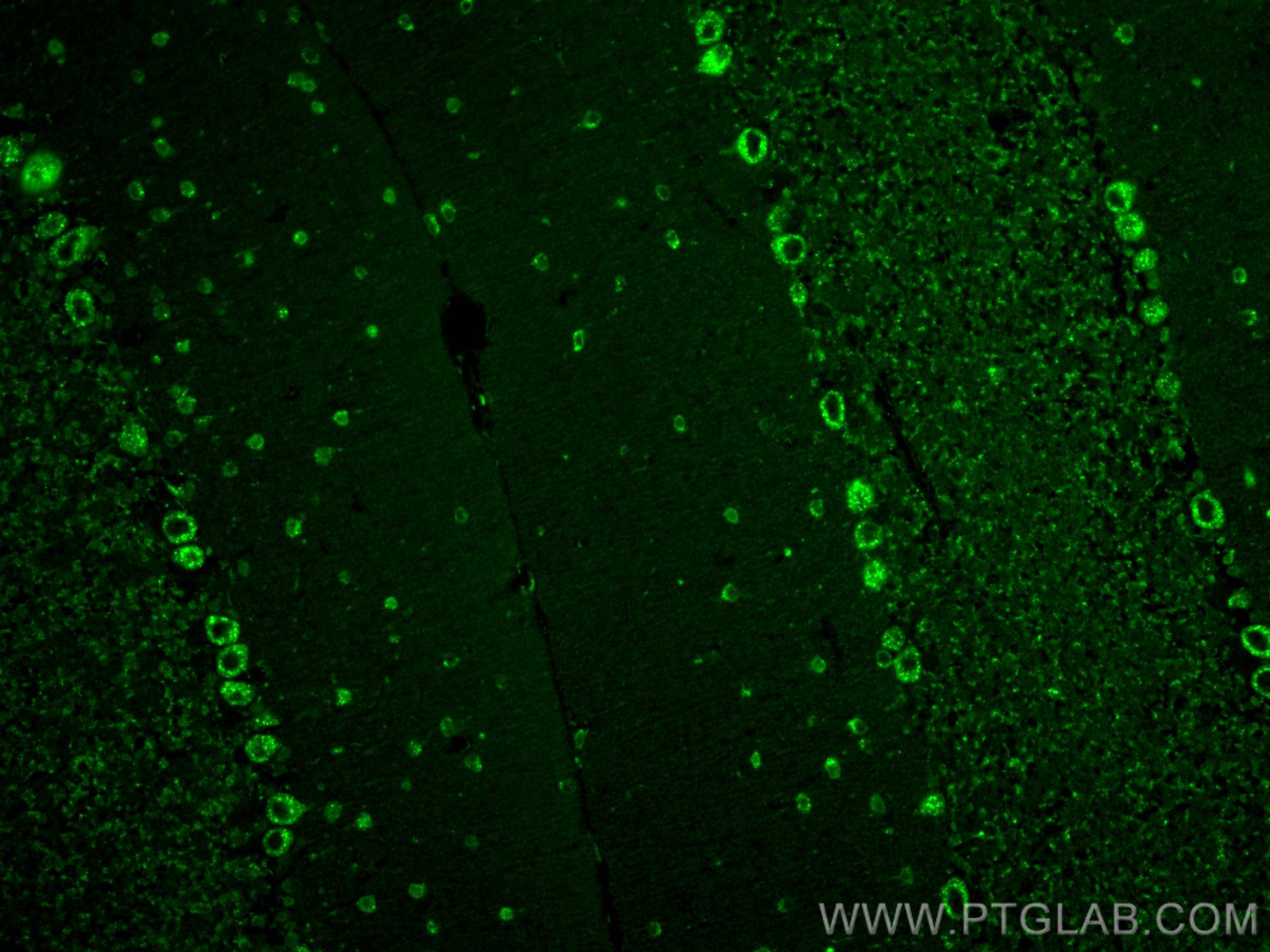 IF Staining of mouse cerebellum using 68651-1-Ig (same clone as 68651-1-PBS)