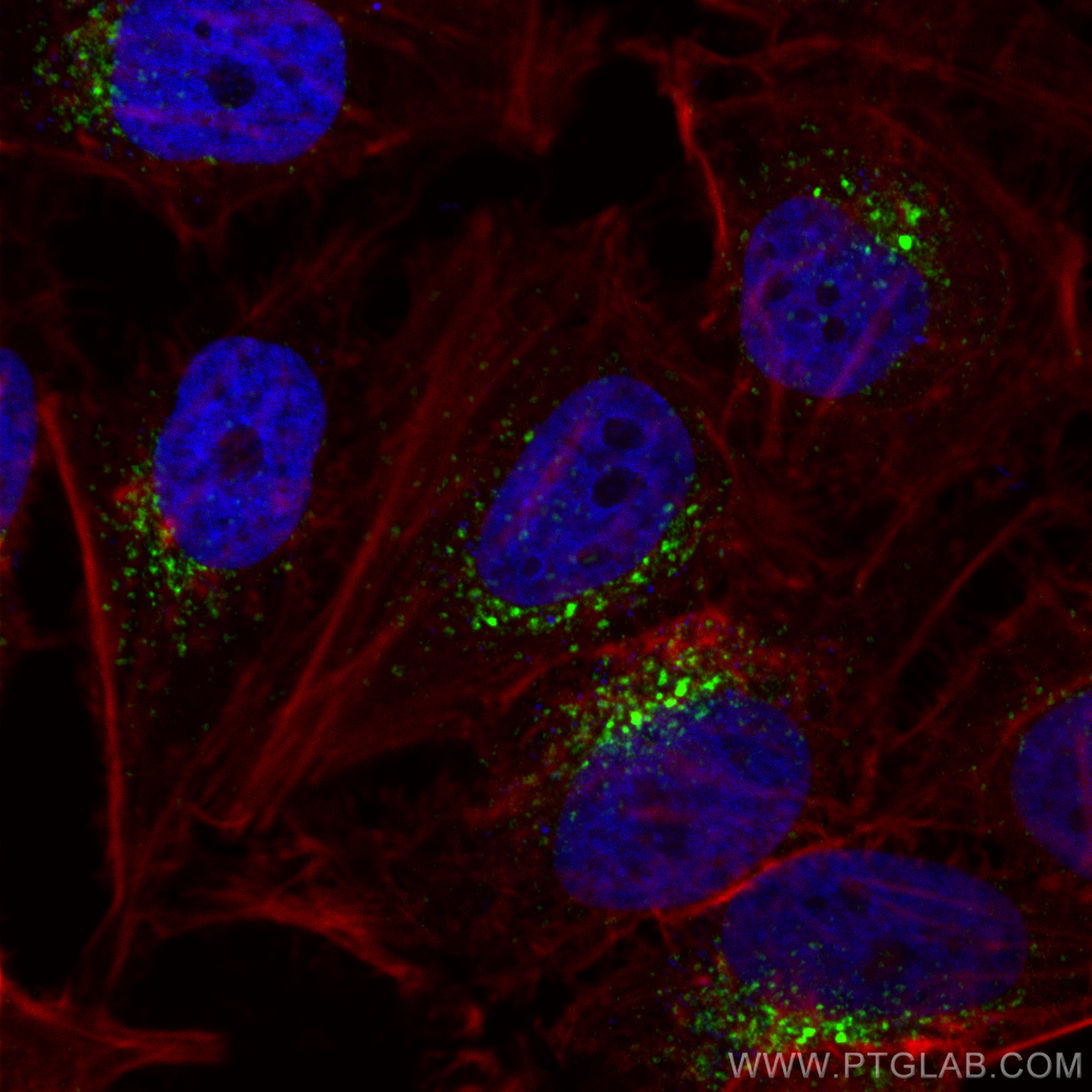 IF Staining of HeLa using 12369-1-AP