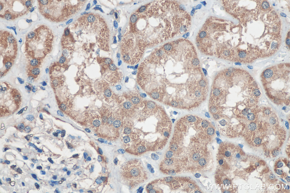 IHC staining of human kidney using 21933-1-AP